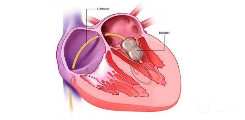 Review of the Department of Vascular Surgery