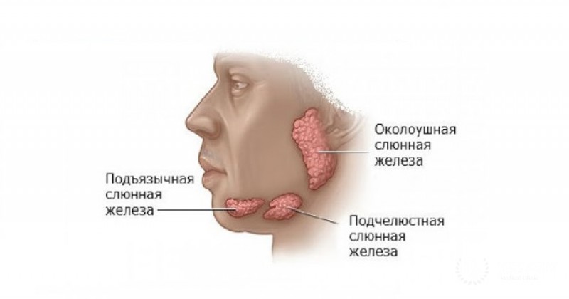 Плеоморфная аденома слюнных желез