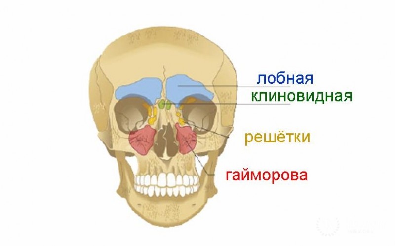 Рак клиновидной и лобных пазух