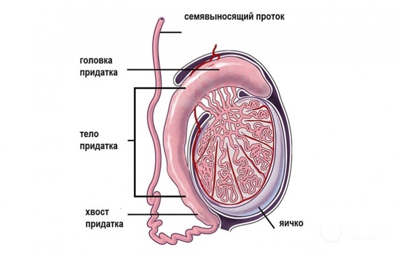 Рабдомиосаркома яичка