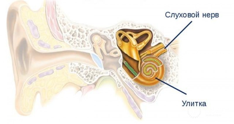 Повреждение слухового нерва: причины, методы диагностики, лечение