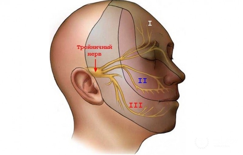 Невралгия тройничного нерва: признаки