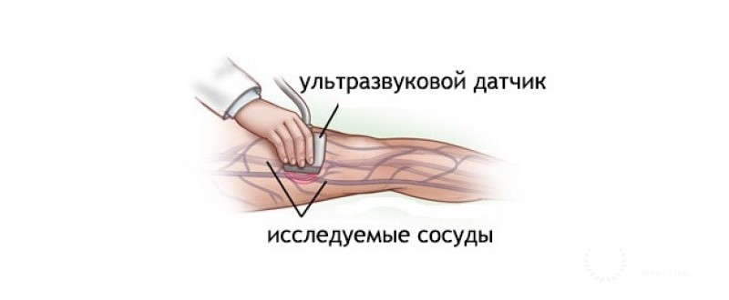 Ультразвуковая допплерография в детской нейрохирургии