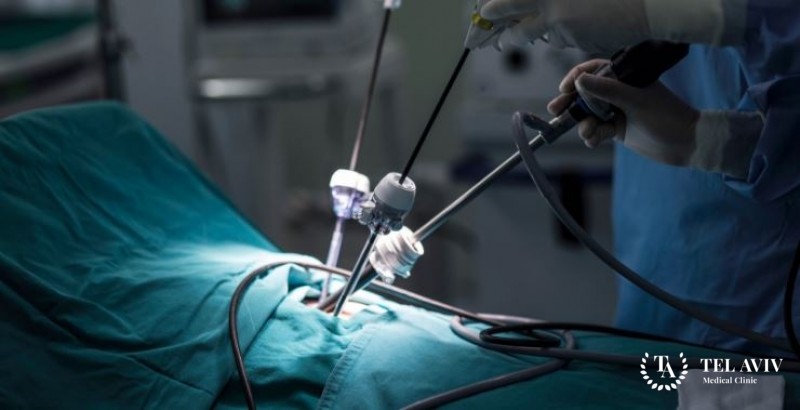 Minimally Invasive Surgery – Laparoscopy