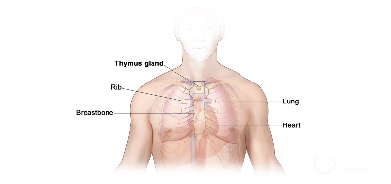 Thymoma & Other Thymic Tumors